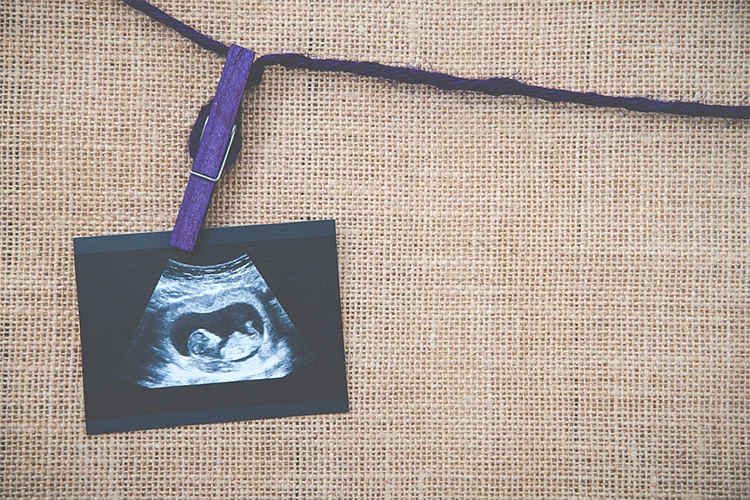 حمایت از مادر بعد از سقط جنین: حضور شما باارزش ا‌ست